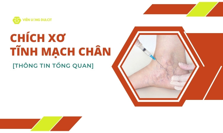 chich-xo-tinh-mach-chan