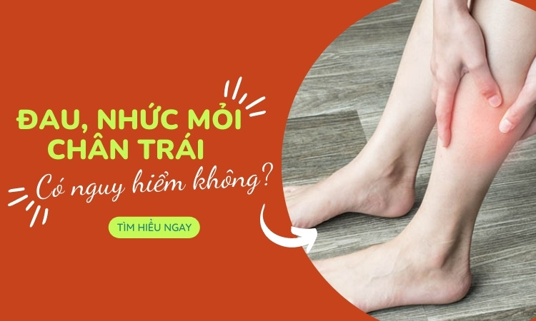 Các bệnh thường gặp khi đau mỏi chân