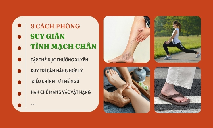 Phương Pháp Điều Trị và Phòng Ngừa