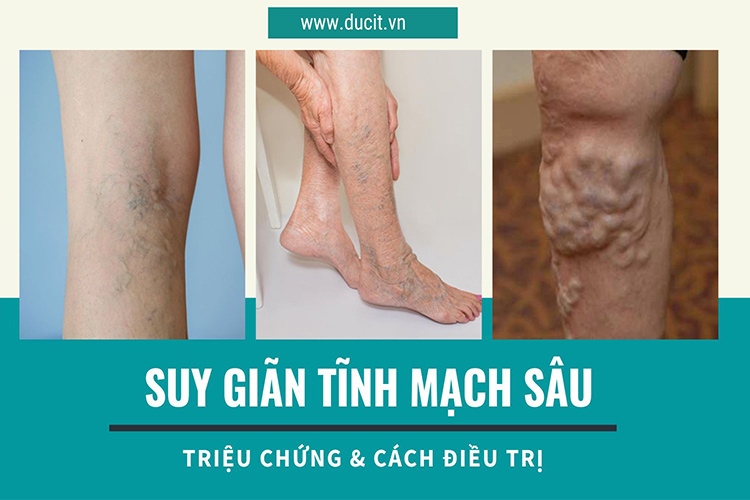 Các câu hỏi thường gặp