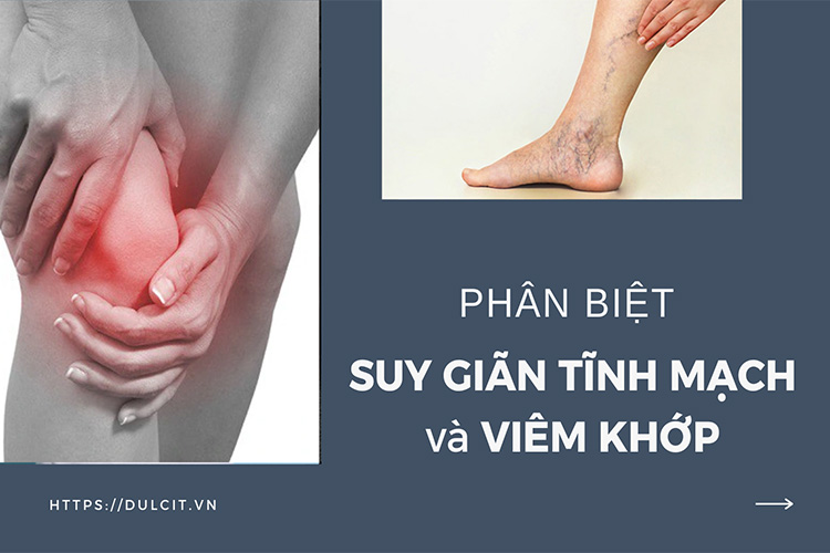 viem-khop-va-gian-tinh-mach