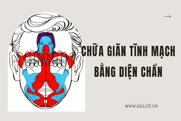 chua-gian-tinh-mach-bang-dien-chan