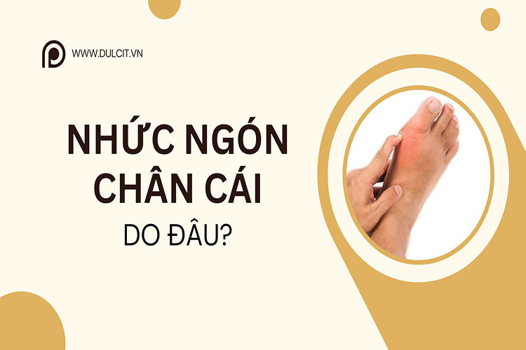 nhuc-ngon-chan-cai