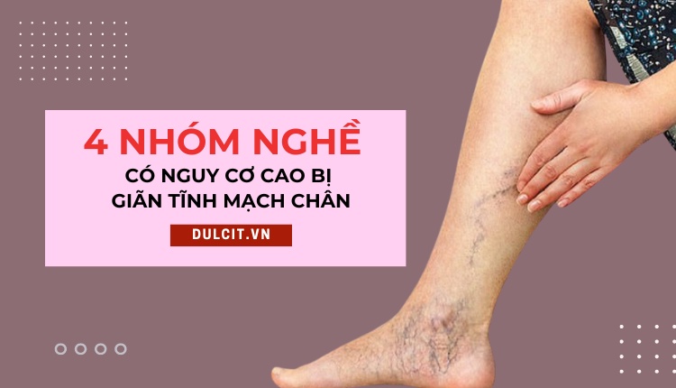 CẢNH BÁO 4 nhóm nghề nghiệp dễ mắc suy giãn tĩnh mạch