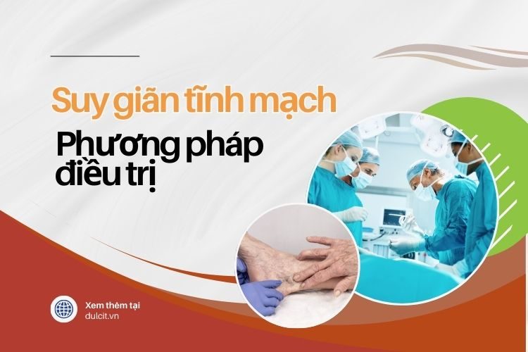 Các phương pháp điều trị suy giãn tĩnh mạch